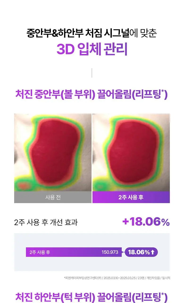[최다증정|기프트] 바이오힐보 프로바이오덤 3D리프팅 스킨케어 3종세트(토너+에멀전+크림) 상세페이지 27